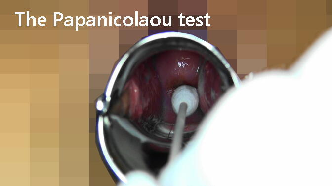 2The Papanicolaou test