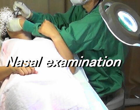Nasal examination